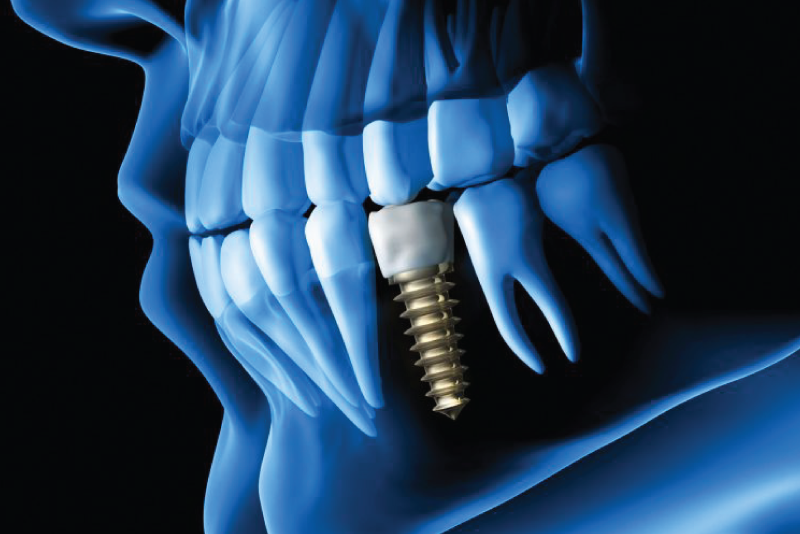 Dentistry on 89 Dr. Parekh and Associates Alliston Dental Clinic Dentists