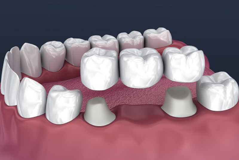 Dentistry on 89 Dr. Parekh and Associates Alliston Dental Clinic Dentists